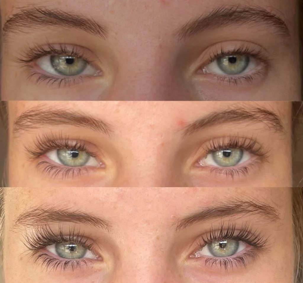 Before and after results